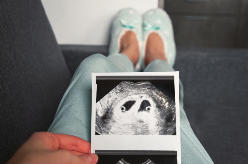 Are multiple pregnancies more risky than single pregnancies?